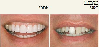 חסר מאפיין alt לתמונה הזו; שם הקובץ הוא 2021-10-24-15_38_25-Window.png