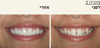 חסר מאפיין alt לתמונה הזו; שם הקובץ הוא 2021-10-24-15_38_35-Window.png