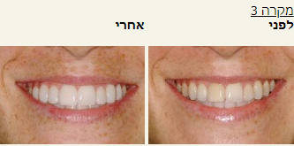 חסר מאפיין alt לתמונה הזו; שם הקובץ הוא 2021-10-24-15_38_42-Window.png