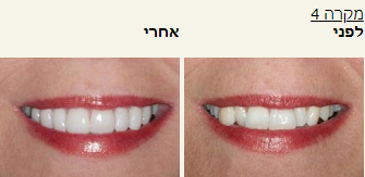 חסר מאפיין alt לתמונה הזו; שם הקובץ הוא 2021-10-24-15_38_50-Window.png