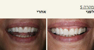 חסר מאפיין alt לתמונה הזו; שם הקובץ הוא 2021-10-24-15_38_57-Window.png