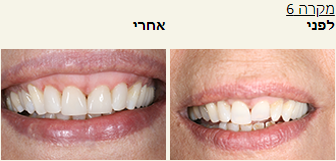 חסר מאפיין alt לתמונה הזו; שם הקובץ הוא 2021-10-24-15_39_06-Window.png